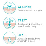 Acne Foaming Cream Cleanser 5OZ