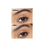 Brow Lift